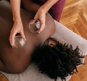 Cupping Therapy at Feel Good Balham