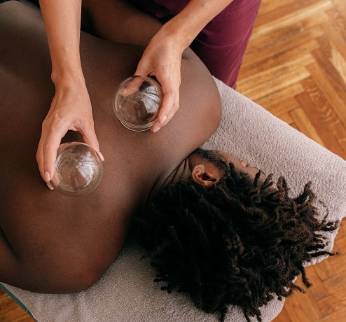 Cupping Therapy at Feel Good Balham